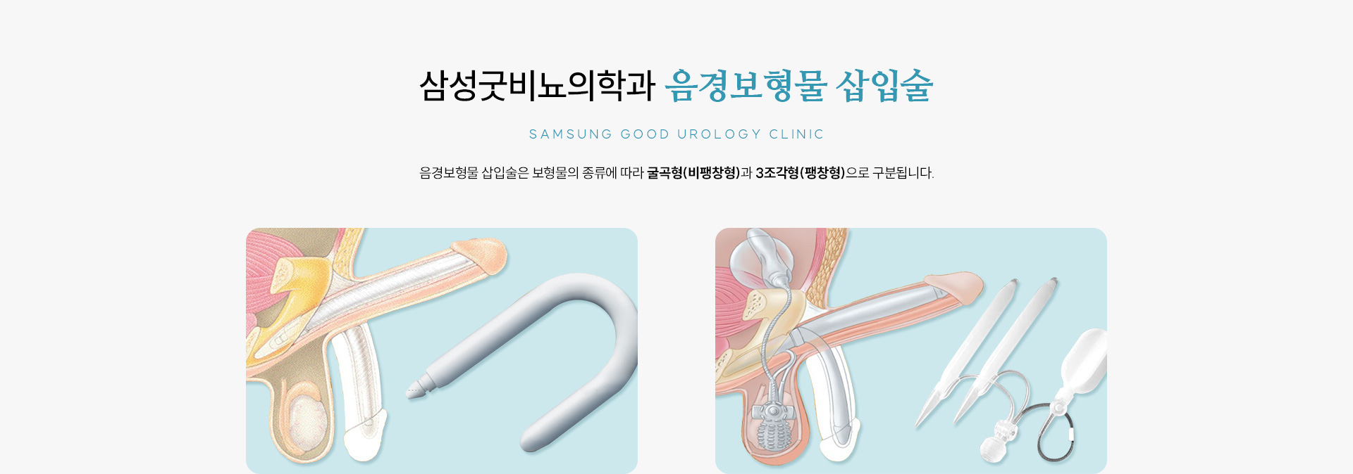 발기부전 클리닉