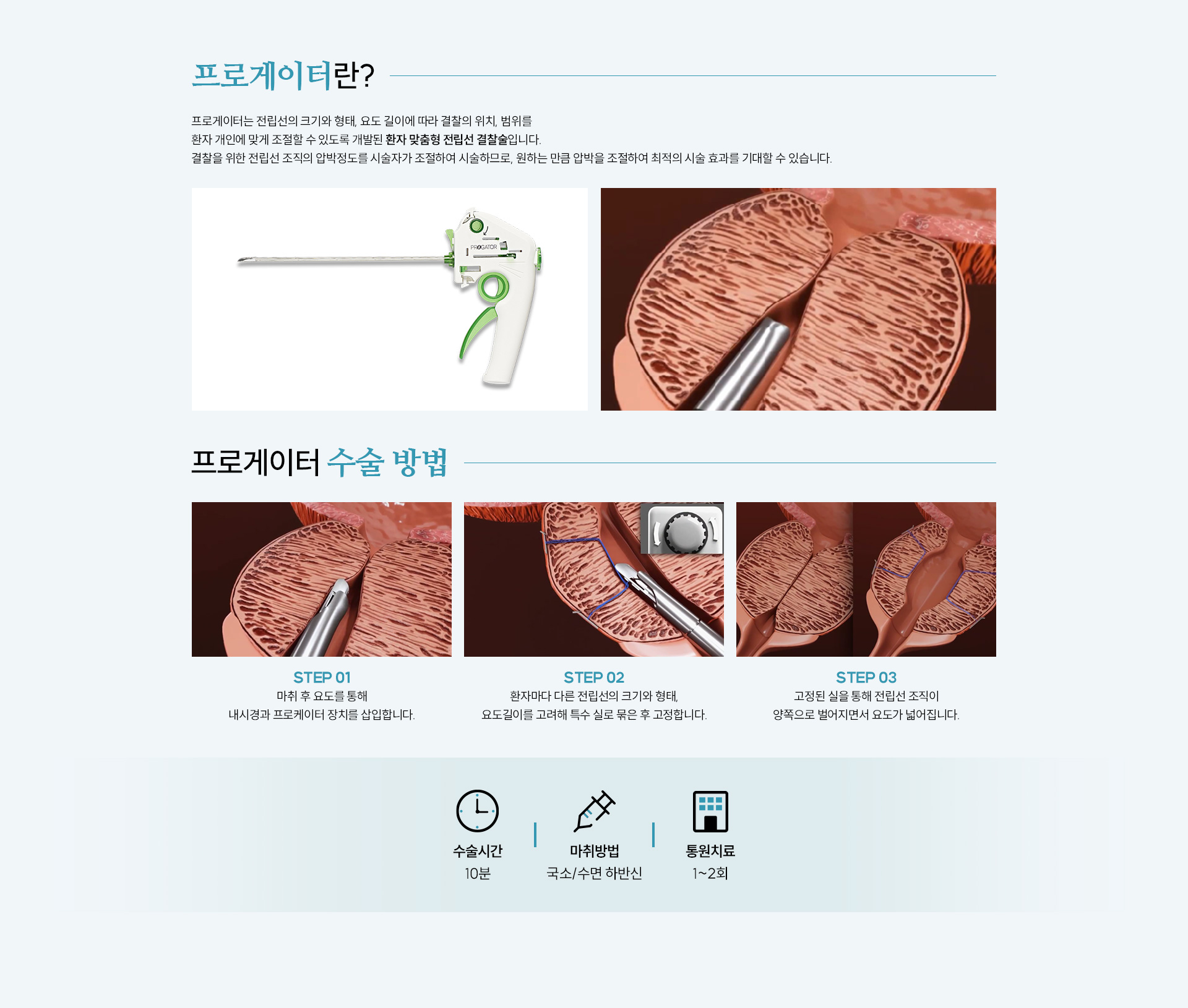전립선비대증
