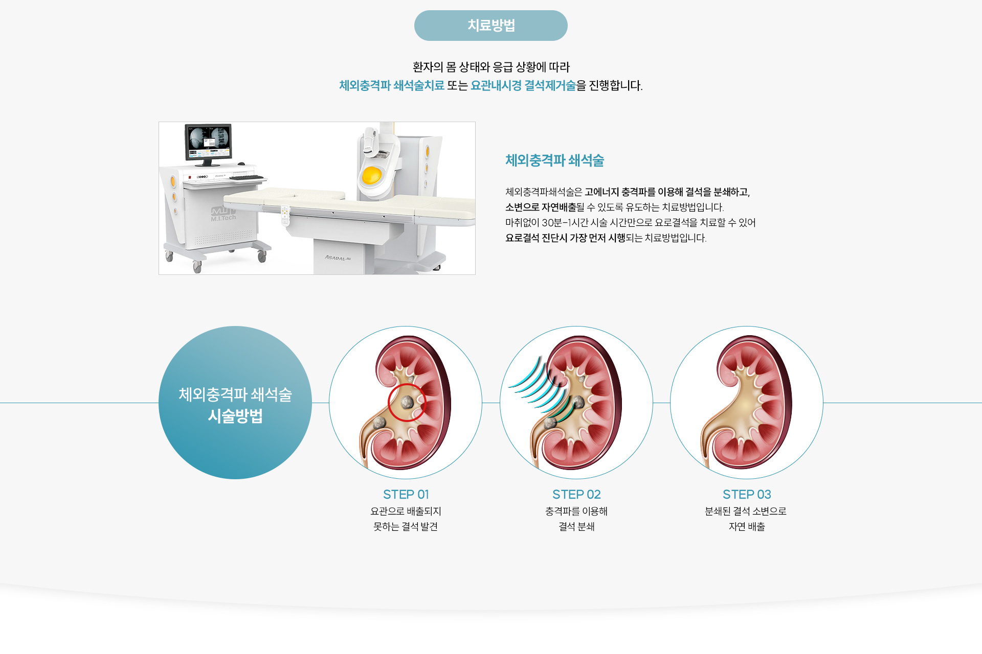 요로결석