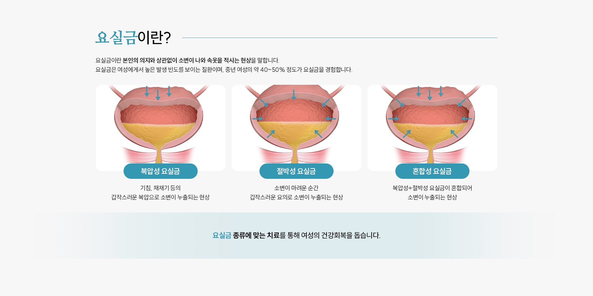 여성비뇨질환